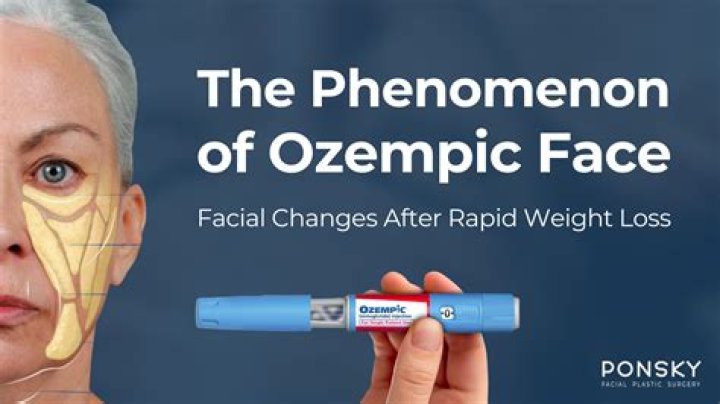 Exploring the Phenomenon of Ozempic Face: Causes, Effects, and Solutions