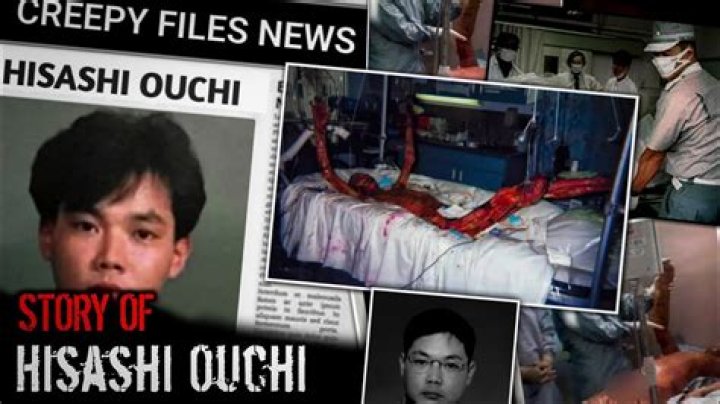 Hisashi Ouchi Is He Dead or Still Alive?