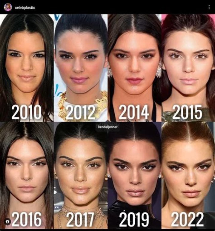 Kendall Jenner: The Evolution of a Cultural Icon in the Spotlight